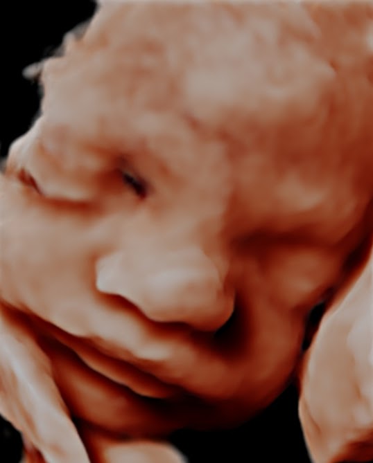 Premium Peek Package 3D/4D- 20 minute scan