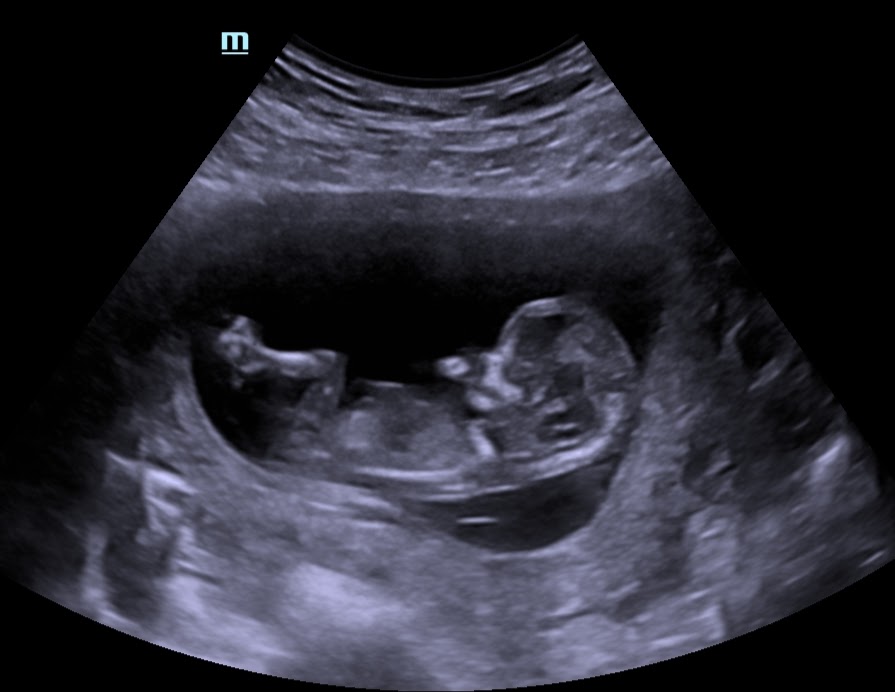 Ultrasound Boutique, United States